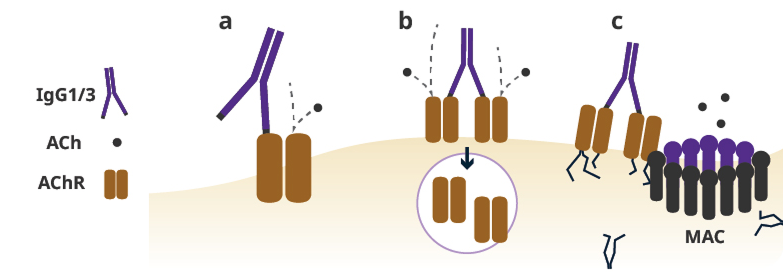Graphic of the pathophysiology of anti-AChR antibody positive (Ab+) gMG.
